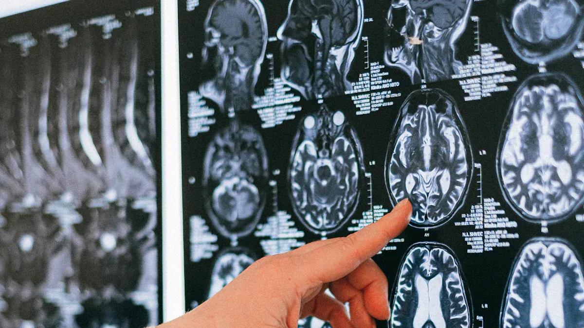 Real-World Impact of AI in Medical Image Analysis