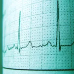 What Is Heart Rate Variability and How Does It Affect Your Health