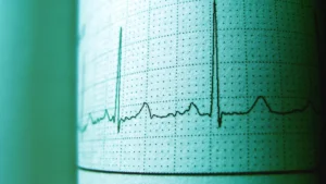 What Is Heart Rate Variability and How Does It Affect Your Health